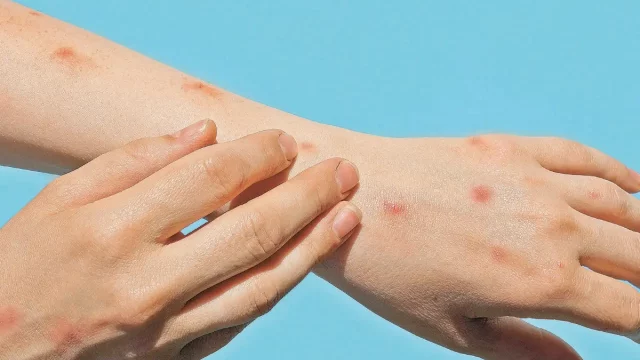 thumb